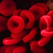 여성 빈혈의 원인, 예방 및 징후 : 치료 기능